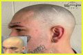 Unveiling The Truth: Steve Austin's Baldness Decoded