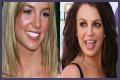 What’s Up with Britney Spears’ Smile? The Scoop on Her Noticeable Gap Teeth